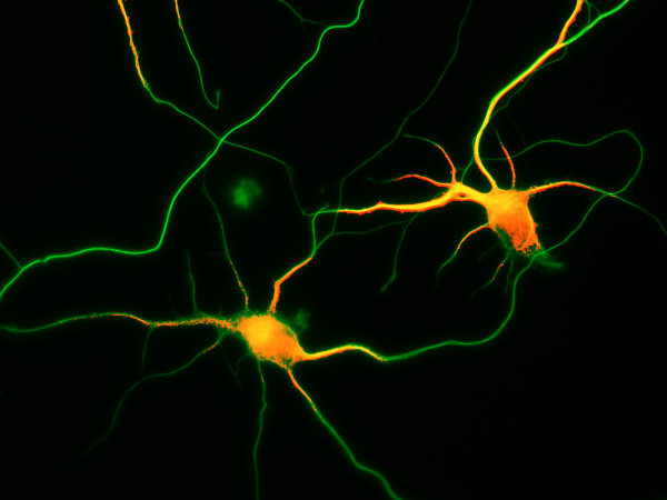 Entwicklung von Axon- und dendritischen Arboren in kultivierten Neuronen des Hippocampus nach 3 Tagen in vitro. 