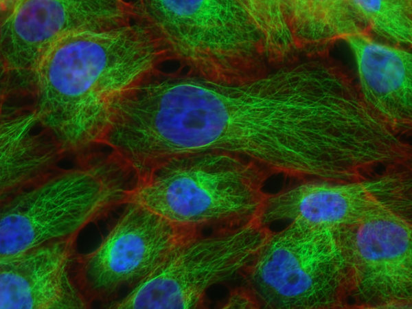 Stressfasern und Mikrotubuli in menschlichen Brustkrebszellen, National Cancer Cells